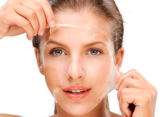 Peeling Químico
